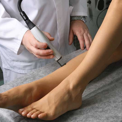Сосудистые звездочки на ногах причины лечение и советы флеболога